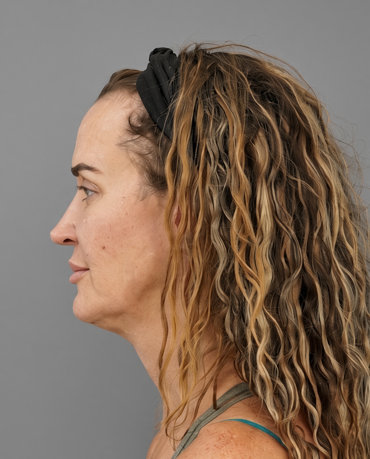 50 Year Old END of Aging Facelift by Dr. Suzanne Trott: Endoscopic Deep Plane Results at 3 Months, before, view 5
