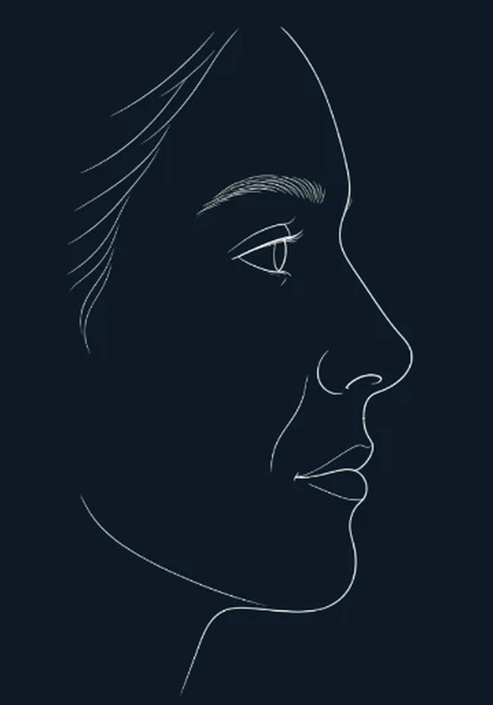 Illustration of mouth corners lifted by the END-of-Aging Facelift