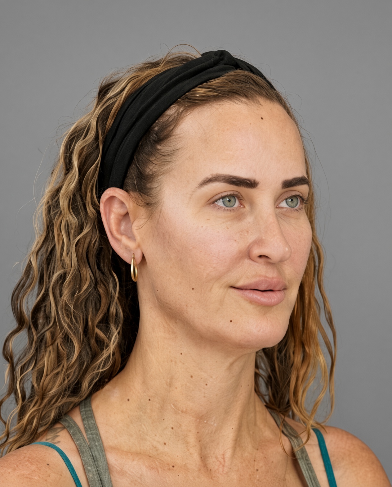 50 Year Old END of Aging Facelift by Dr. Suzanne Trott: Endoscopic Deep Plane Results at 3 Months, before, view 2