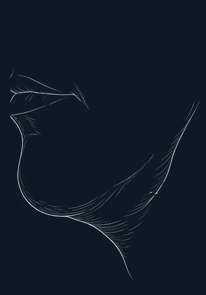 Illustration of jowls refined by the END-of-Aging Facelift