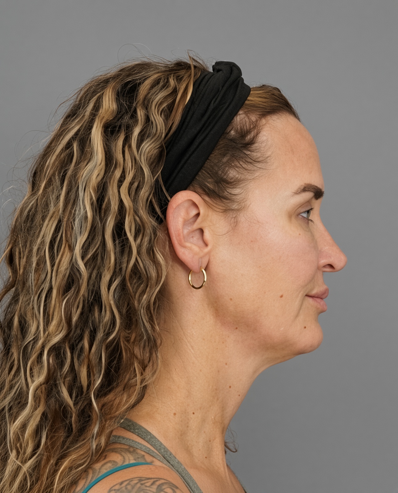 50 Year Old END of Aging Facelift by Dr. Suzanne Trott: Endoscopic Deep Plane Results at 3 Months, before, view 3