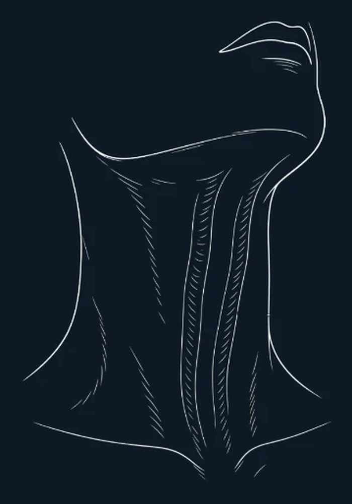 Illustration of neck contouring with the END-of-Aging Facelift