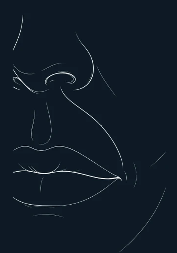 Illustration of nasolabial folds softened by the END-of-Aging Facelift